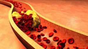 The Quickest Way How to Reduce Cholesterol Levels Naturally